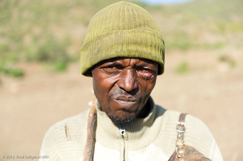 20120403_081228 Nikon D3S (4) 2x3.jpg - Farmer with conjunctivitis and more